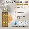 AILKE Collagen 5-in-1 Skin Care Set - Thumbnail Image 2
